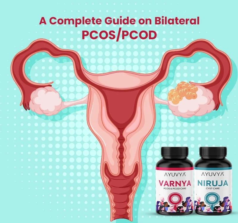 A Complete Guide On Bilateral PCOS/PCOD